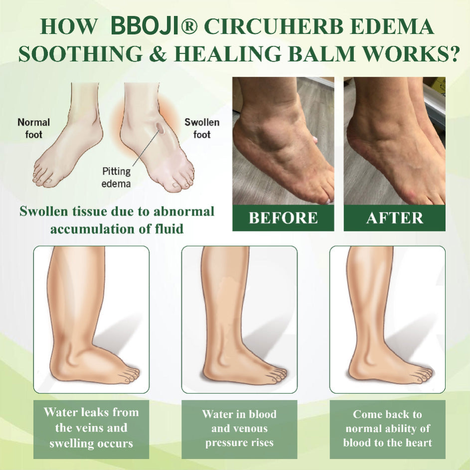 BBOJI® CircuHerb Edema Soothing & Healing Balm