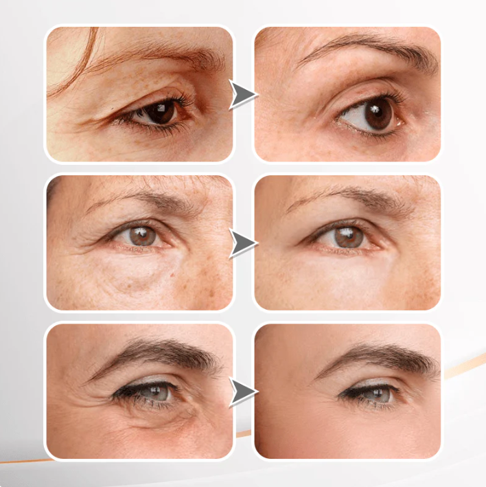 🌸 Instant Temporary Face Tightener – Smooth Fine Lines & Lift in Seconds! ✨