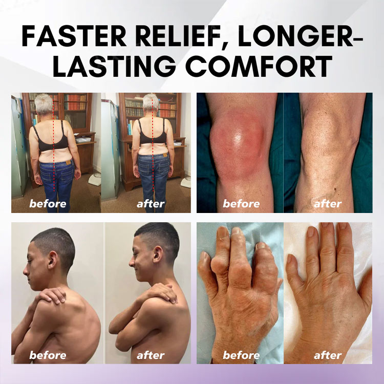 LOVILDS™ Turmeric & Emu Oil Arthritis Soothing Pain Relief Massage Gel 👨⚕️Australian Osteopathic Association (AOA)Approved