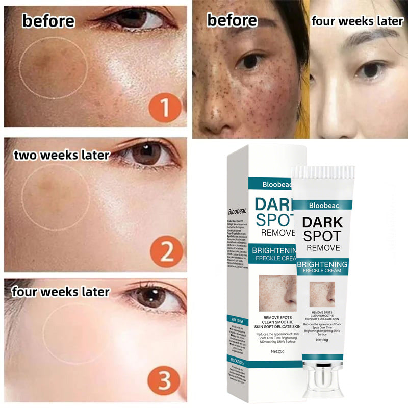 Bloobeac® Blemish Cream – Fade Age Spots, Freckles & Wrinkles | Youthful, Radiant Skin