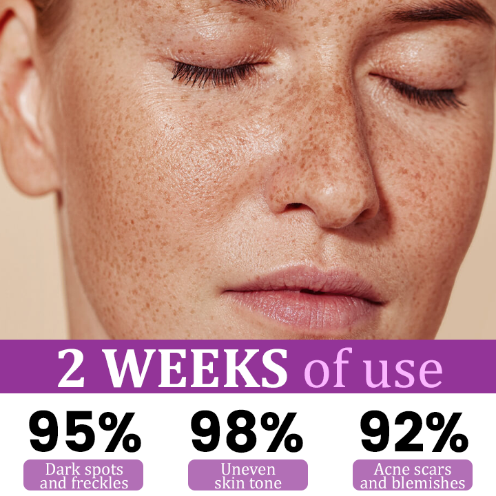 Glowrizon™ MelantraX Advanced Anti-Hyperpigmentation Essence