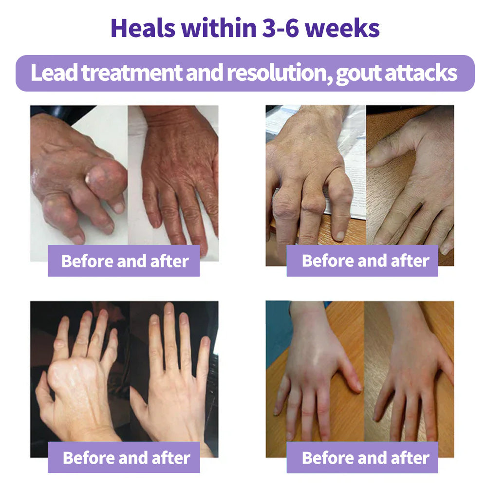 LOVILDS™ Turmeric & Emu Oil Arthritis Soothing Pain Relief Massage Gel 👨⚕️Australian Osteopathic Association (AOA)Approved