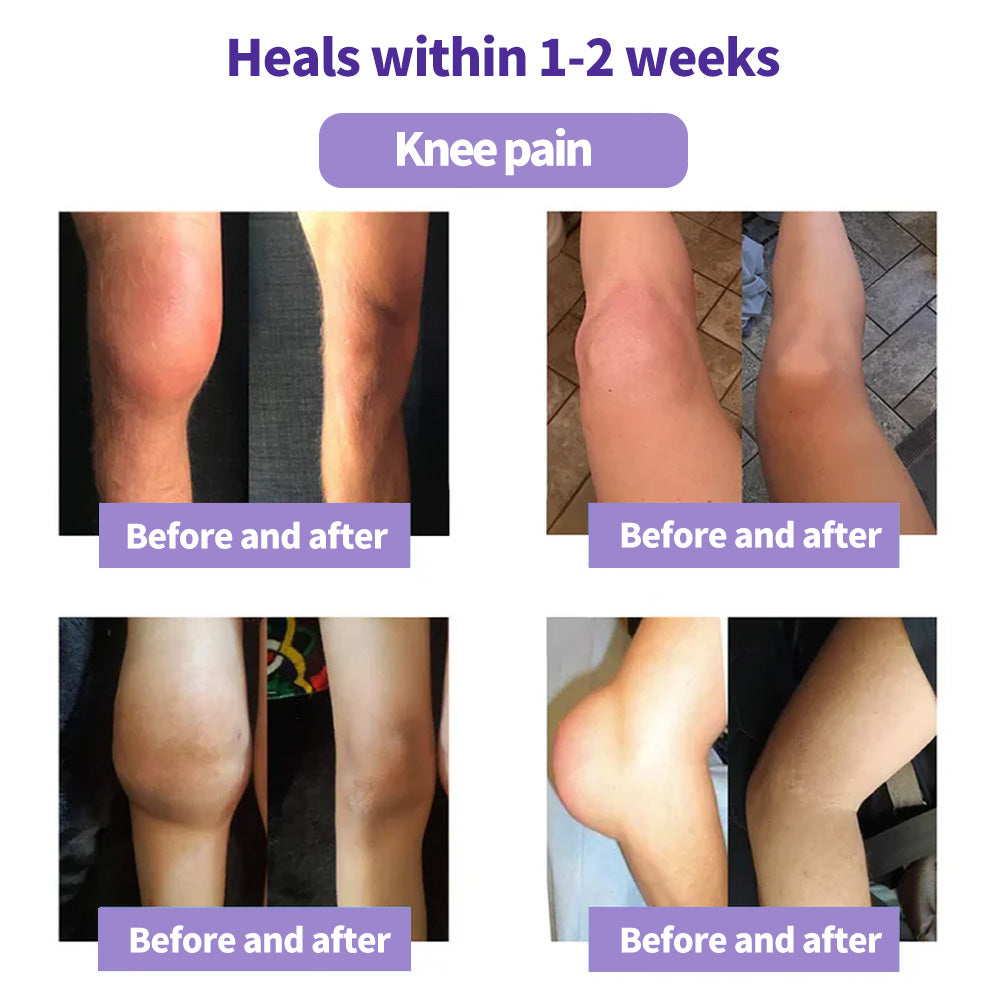 LOVILDS™ Turmeric & Emu Oil Arthritis Soothing Pain Relief Massage Gel 👨⚕️Australian Osteopathic Association (AOA)Approved