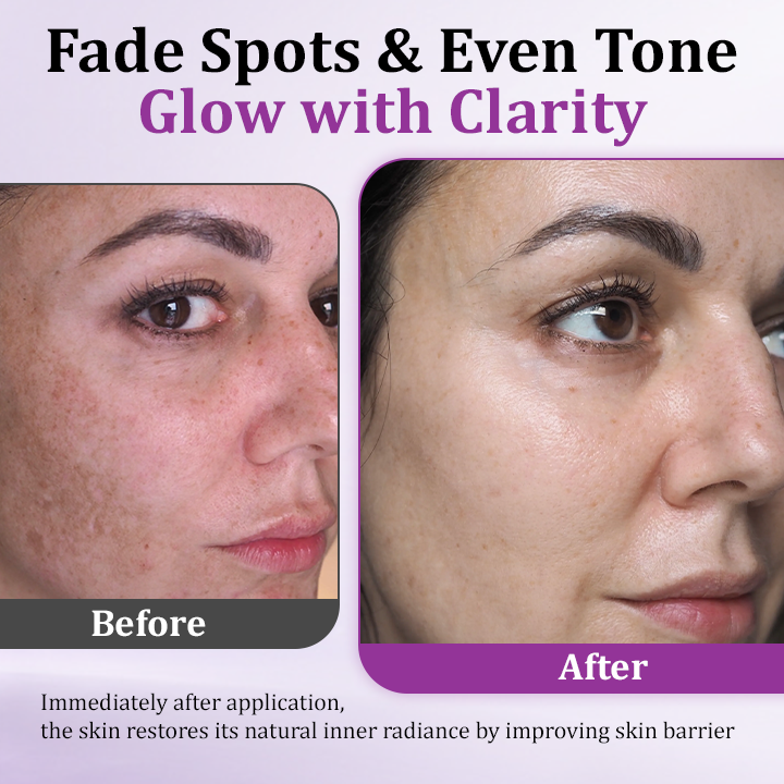 Glowrizon™ MelantraX Advanced Anti-Hyperpigmentation Essence