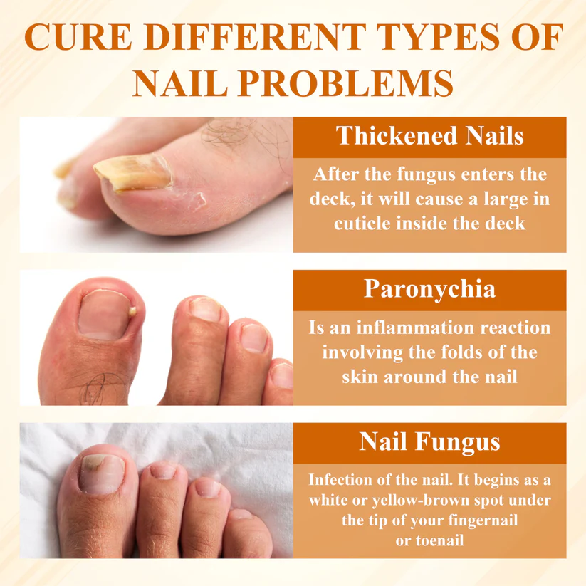BBOJI® Fungiclear Bee Therapy Nail Spray