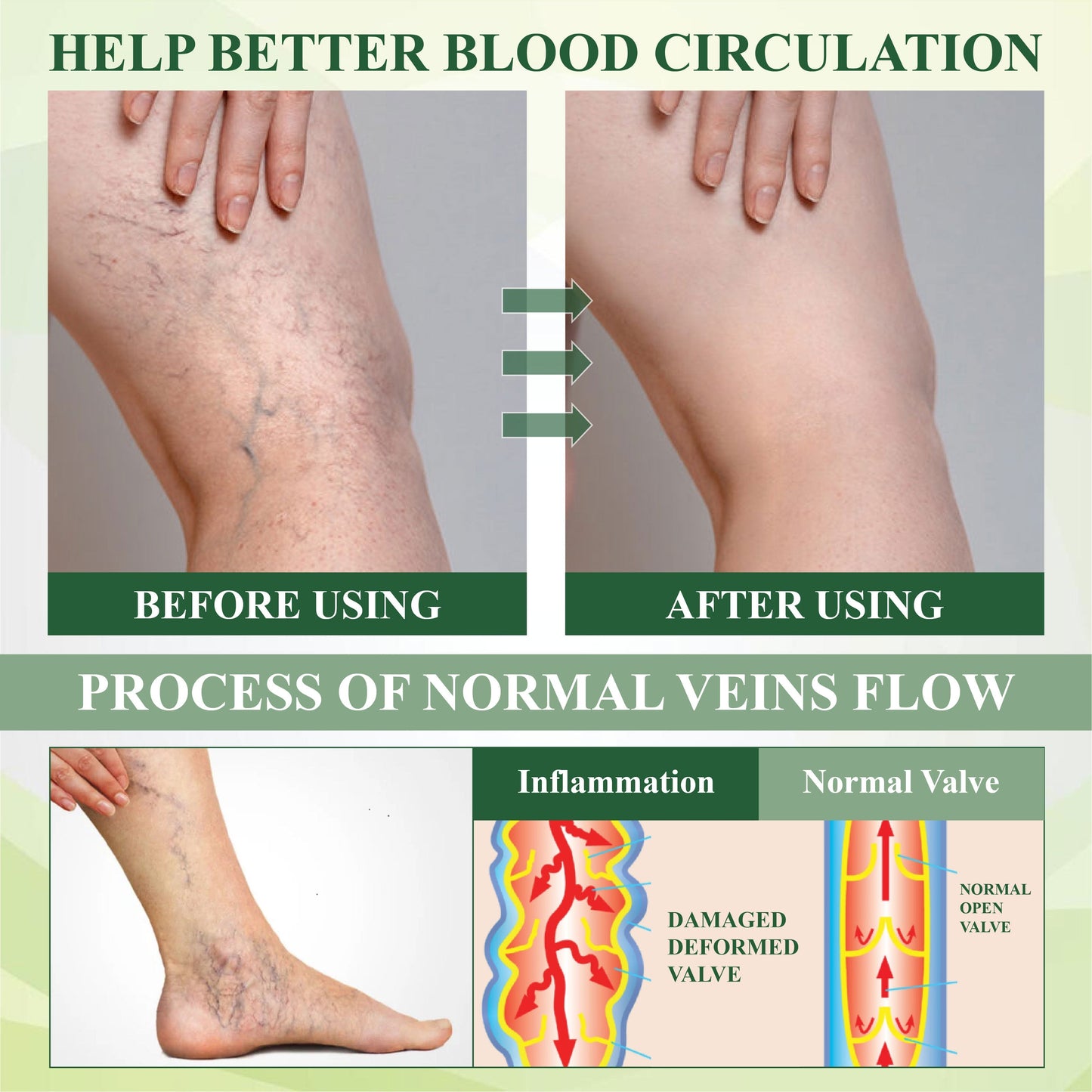 BBOJI® CircuHerb Edema Soothing & Healing Balm