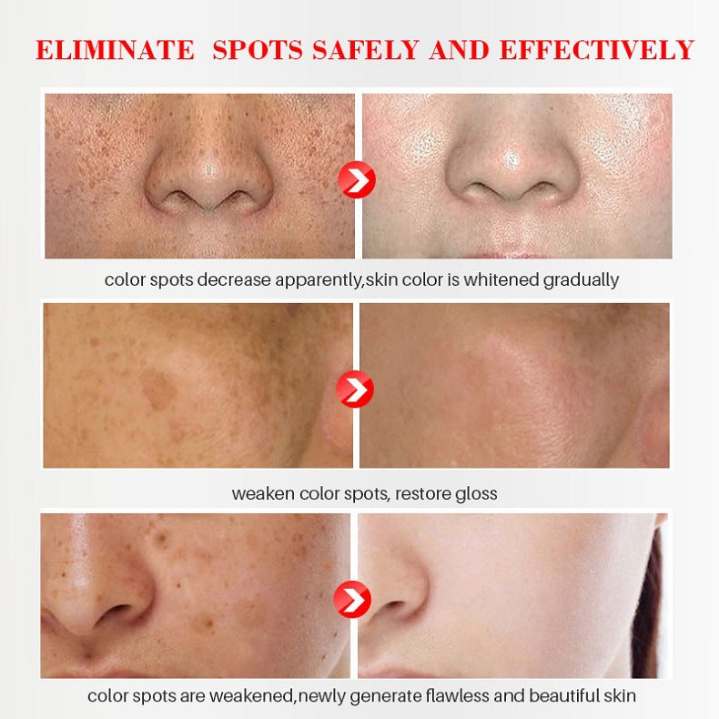 Bloobeac® Blemish Cream – Fade Age Spots, Freckles & Wrinkles | Youthful, Radiant Skin