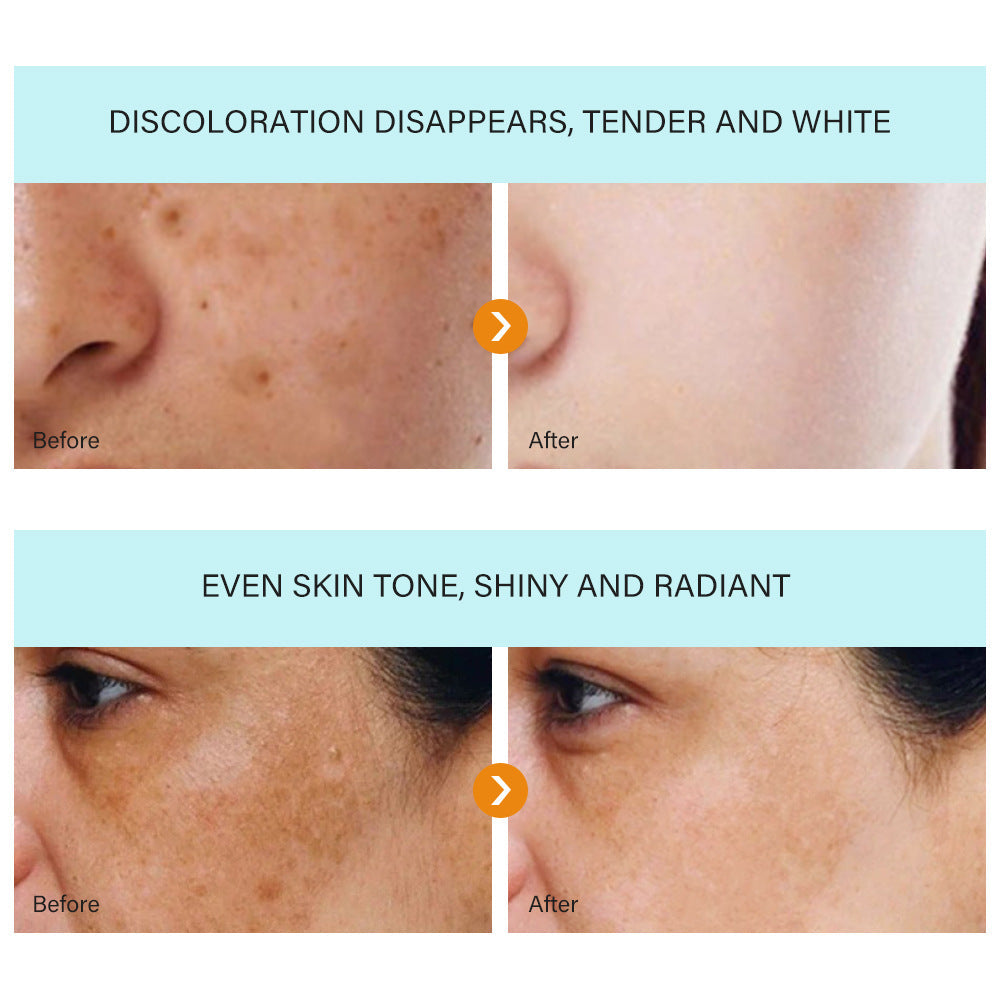 Bloobeac® Blemish Cream – Fade Age Spots, Freckles & Wrinkles | Youthful, Radiant Skin