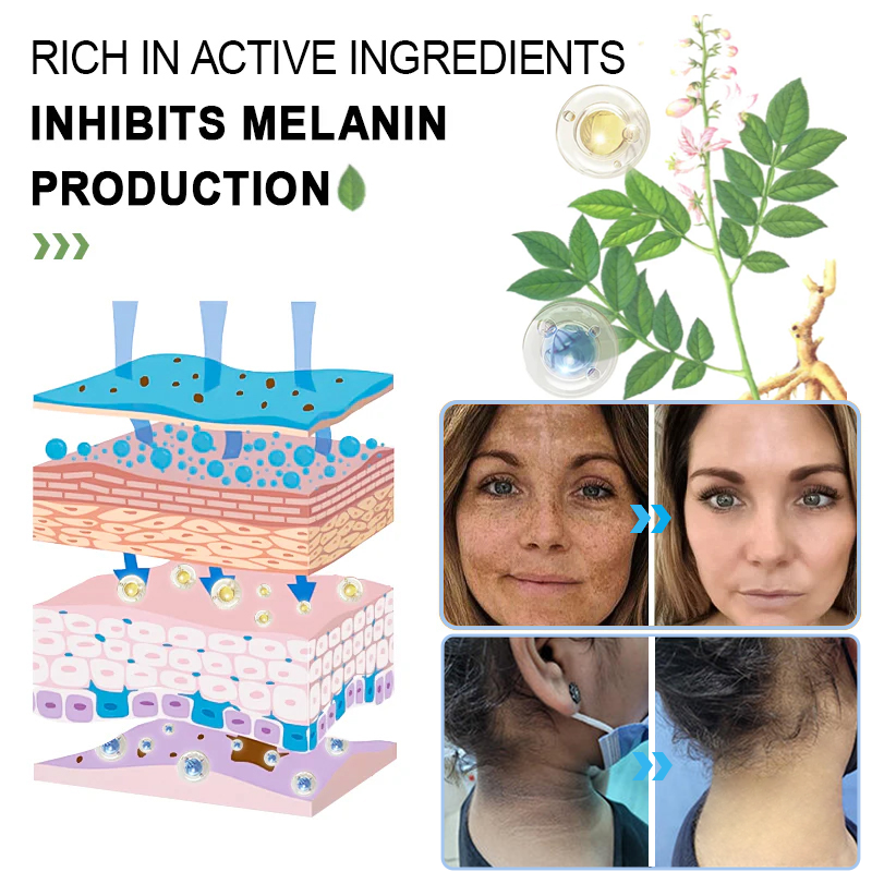 NESLEMY™ gentle Purifying Exfoliating Gel for Acanthosis Nigricans and Dark Spots,ect