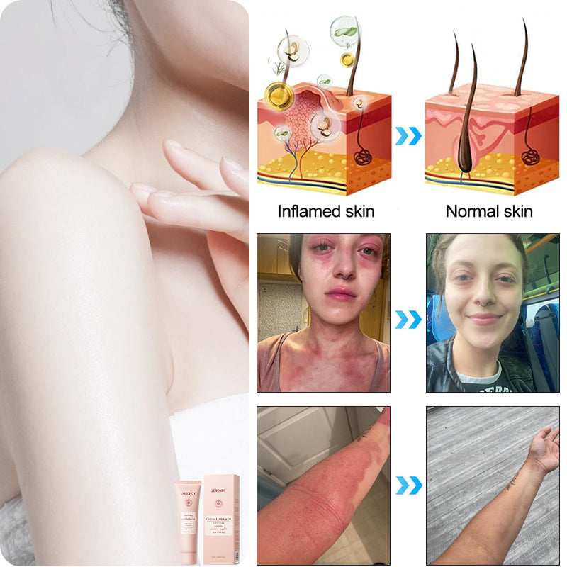 NESLEMY™ gentle Purifying Exfoliating Gel for Acanthosis Nigricans and Dark Spots,ect