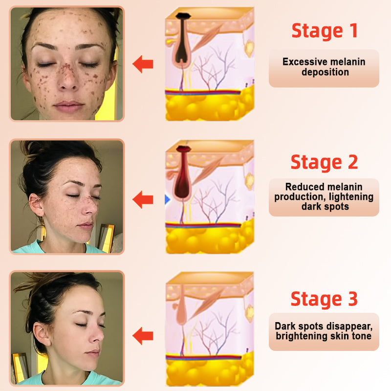 NESLEMY™ gentle Purifying Exfoliating Gel for Acanthosis Nigricans and Dark Spots,ect