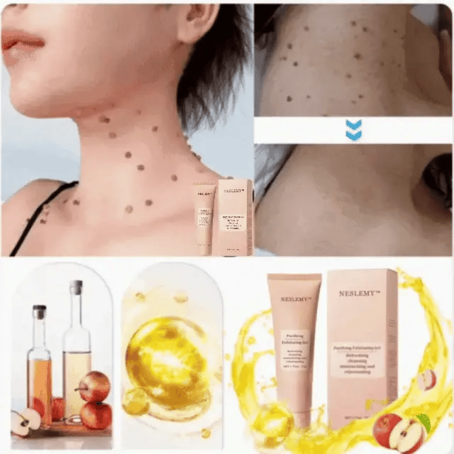 NESLEMY™ gentle Purifying Exfoliating Gel for Acanthosis Nigricans and Dark Spots,ect